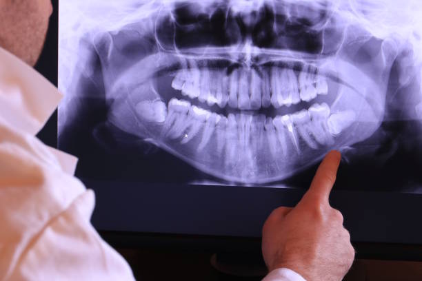 Best Orthodontic Emergency Dentist in Carey, OH